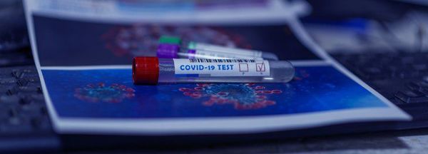 COVID-19: Concepción con dos casos sin nexo y 10 activos