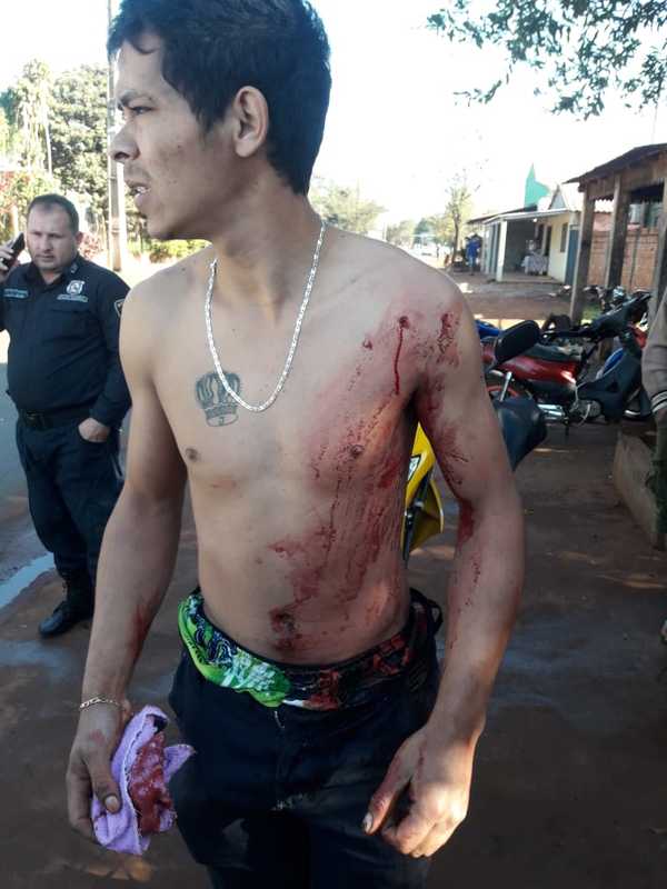 Joven con antecedentes es baleado frente a su casa en presunto ajuste de cuentas