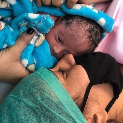Nació Oliver, el bebé que fue intervenido quirúrgicamente dentro del útero materno