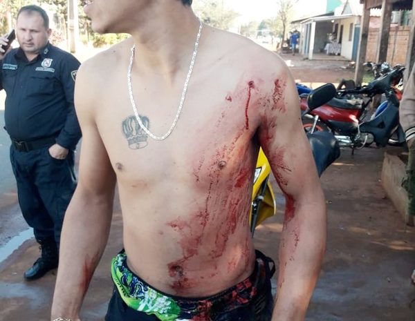 Un sujeto con prontuario policial es  atacado y baleado frente a su casa – Diario TNPRESS