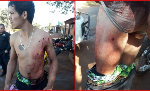 Por aparente venganza un joven es baleado frente a su casa