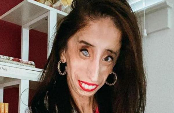 Mujer que sufre raras enfermedades pide que dejen de usar su rostro para una broma cruel en TikTok - SNT