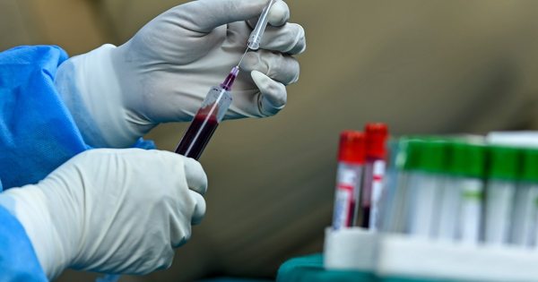 Buscan que el Ejecutivo realice intensas campañas a favor de la donación de plasma