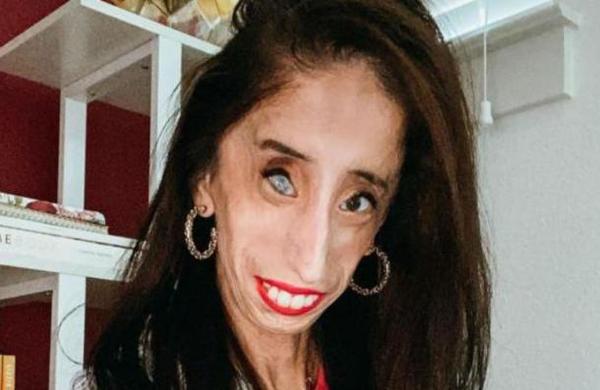 Mujer que sufre raras enfermedades pide que dejen de usar su rostro para una broma cruel en TikTok - C9N