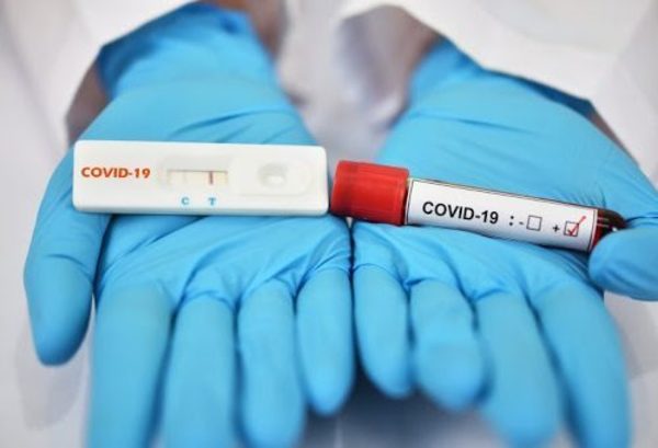 Testeos de Covid: “capacidad diagnóstica sigue en franco crecimiento”, aseguran - ADN Paraguayo