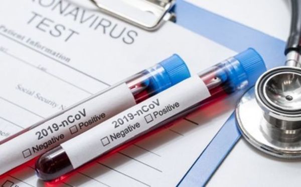 Número de casos de coronavirus llega a 8.018 en el país » Ñanduti