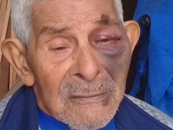 Molió a golpes a su papá por pedirle que desenchufe el cargador