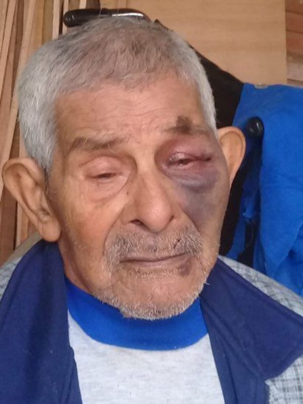 Molió a golpes a su papá por pedirle que desenchufe el cargador