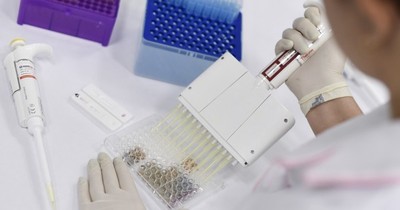 Toma de muestras debe realizarse con otro criterio, dice Sociedad de Microbiología