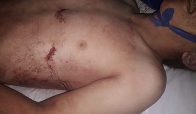 Imputan a hermanos que habrían asesinado a menor