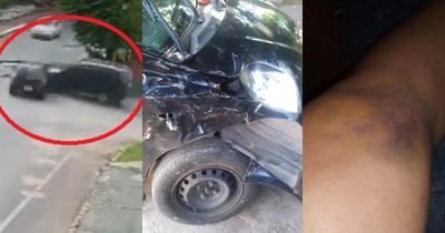 Hermano de Marly Figueredo no se hace cargo de grave accidente de tránsito, denuncian