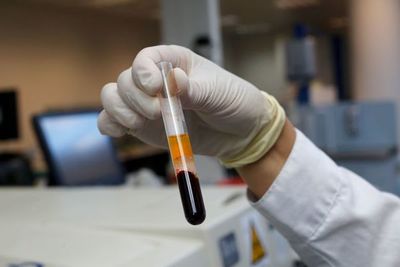 ¿Cómo saber si alguien ya se contagió de COVID-19 sin haber tenido síntomas? - Nacionales - ABC Color