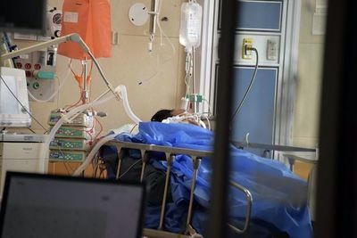 Difícilmente logran salvarse los pacientes con COVID-19 que llegan a requerir de respirador mecánico  - Nacionales - ABC Color