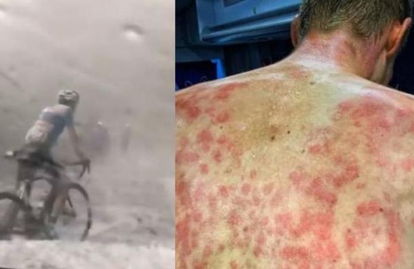 Las impactantes imágenes de las espaldas de unos ciclistas tras correr bajo una lluvia de granizos - C9N