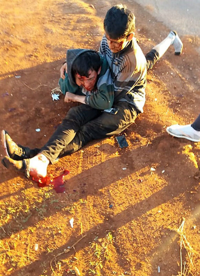 IMPRUDENCIA deja dos heridos en accidente con moto en el CRUCE DEL AMOR