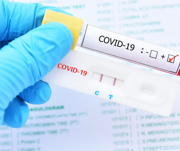 ¡Con 11 nuevos decesos Paraguay supera los 100 fallecidos por COVID!