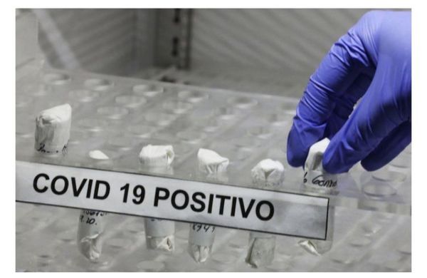 Salud reporta 19 fallecidos por Covid-19 y 359 casos nuevos