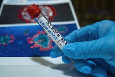 Salud reporta 19 fallecidos por Covid-19 y 359 casos nuevos - Digital Misiones