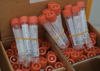 Paraguay recibirá recursos para la compra de 140.000 test de COVID-19