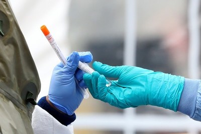 FOCEM aporta 150.000 dólares para compra de kits de testeos de Covid-19 - ADN Paraguayo