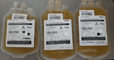 Realizan primeras transfusiones de plasma a dos mujeres con COVID-19 en Alto Paraná