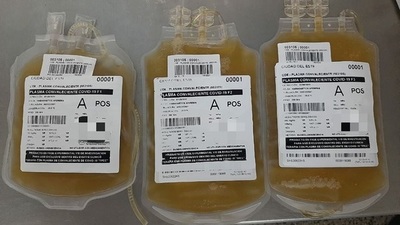 Alto Paraná: ya se utilizan primeras transfusiones de plasma convaleciente - El Trueno