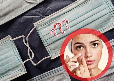 Dudas frecuentes y curiosas: ¿El uso de mascarillas propicia la aparición de acné? - Megacadena — Últimas Noticias de Paraguay
