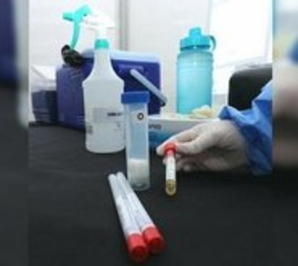 Informe Covid-19: 4 fallecidos y 527 positivos - Paraguay.com