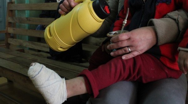 ¡ATENTI CON LOS NIÑOS!: Oky las quemaduras por el mate | Crónica