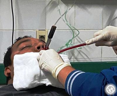 Ex convicto llegó al hospital de Luque con un cuchillo clavado en el rostro •