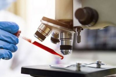 Para la OMS el Covid19 recién desaparecerá a final del 2021