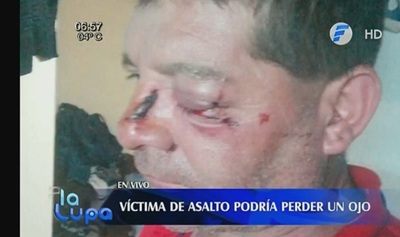 Golpean a un hombre con varilla de hierro para asaltarlo
