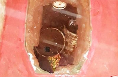 Investigan la existencia de un nuevo túnel debajo del penal de Pedro Juan - Nacionales - ABC Color