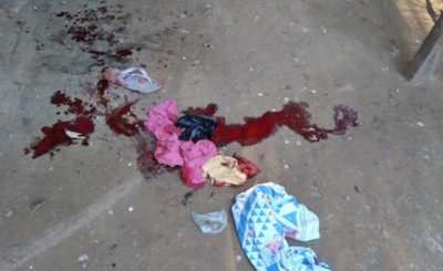 Joven es apuñalado en la nuca y la pierna en ronda de tragos