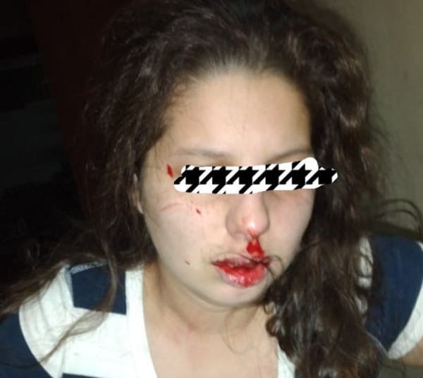 “Me rompió la nariz, apretó mi cuello y me arrastró del pelo”, denuncia mujer, el criminal huyó