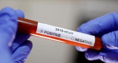 Holanda y Bélgica registran también casos de reinfección por coronavirus » Ñanduti