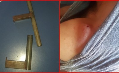Disparó a un amigo con un arma casera y ahora está imputado