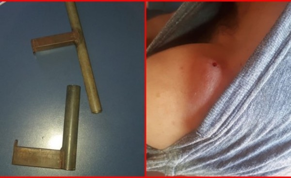 Disparó a un amigo con un arma casera y ahora está imputado