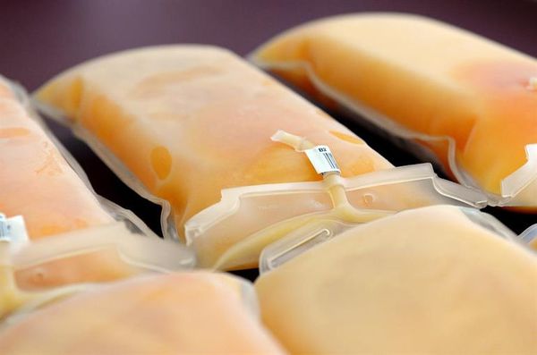 Donación de plasma ya benefició a 25 pacientes de COVID-19 - Nacionales - ABC Color