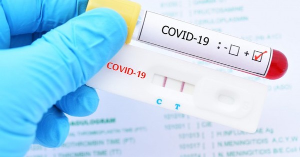 La Nación / Registran primer fallecido indígena por COVID-19