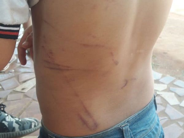 Niño con lesiones en el cuerpo fue hallado deambulando en la calle