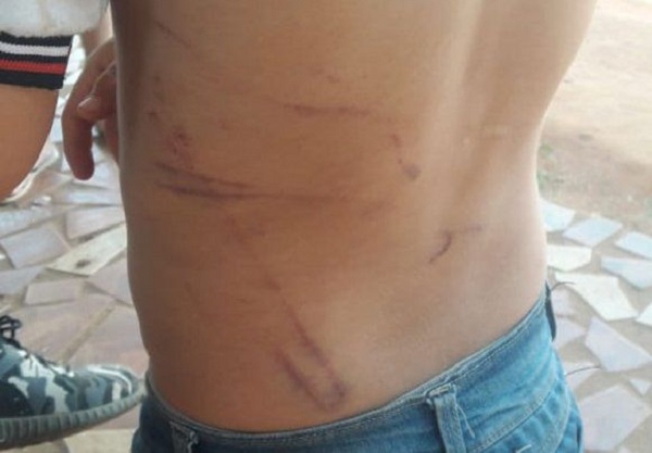 Niño con lesiones en el cuerpo fue hallado deambulando en la calle - Noticiero Paraguay
