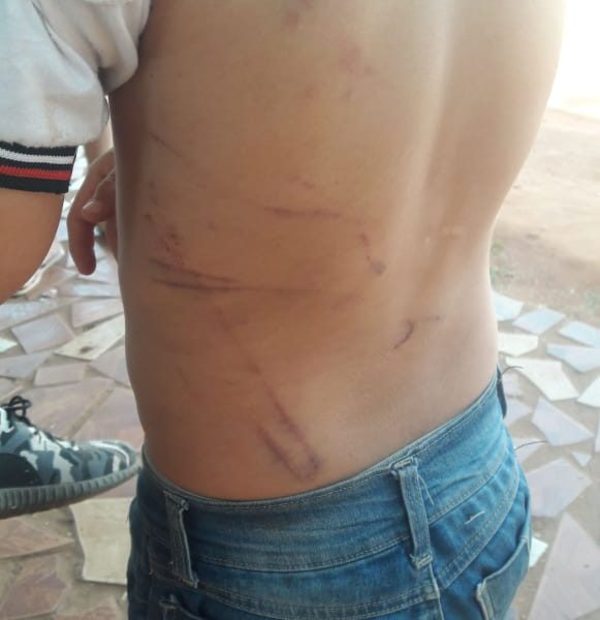 Niño de 7 golpeado por su padrastro deambulaba por la calle