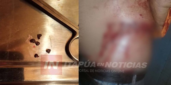 HOMBRE DISPARÓ CON ESCOPETA CONTRA SU VECINO Y FUE APREHENDIDO EN ITAPÚA POTY.