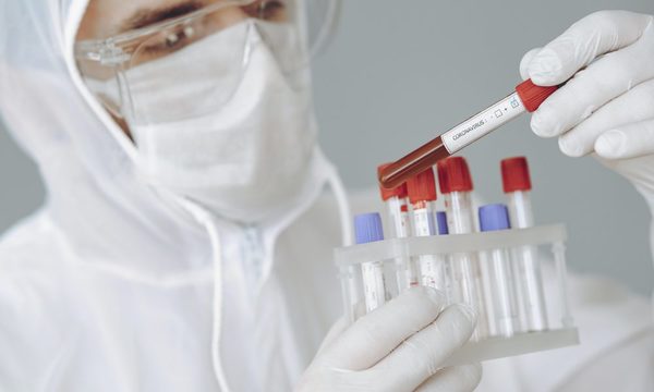 Garantizan 10.000 hisopados más en Alto Paraná