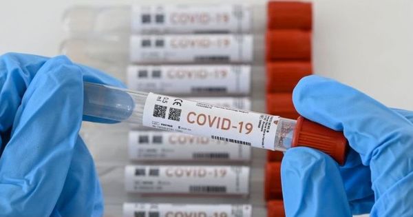 Covid-19: suman 18 decesos y 418 nuevos contagios | Radio Regional 660 AM