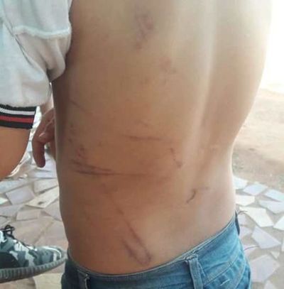 Investigan a padrastro por brutal castigo a niño de 7 años - ABC en el Este - ABC Color