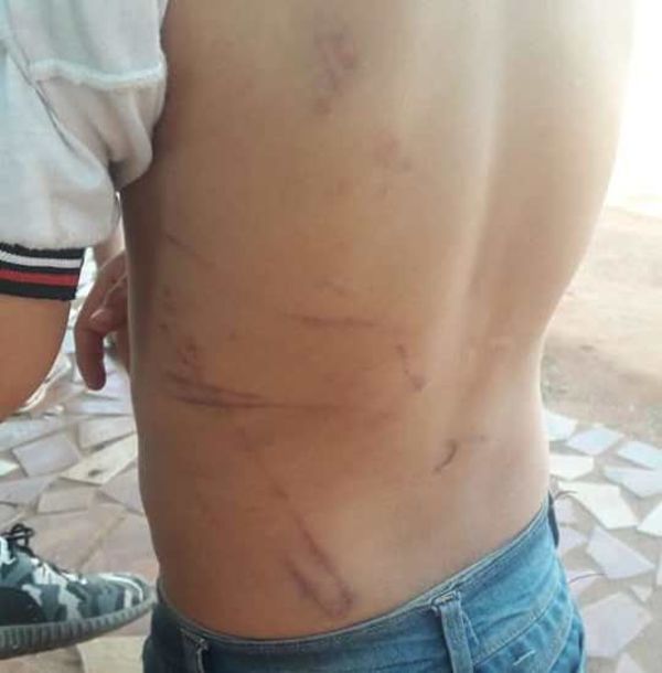 Investigan a padrastro por brutal castigo a niño de 7 años - ABC en el Este - ABC Color