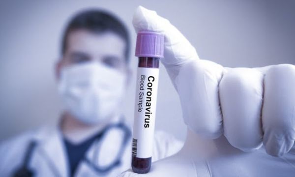 Reportan 15 fallecidos y 583 casos positivos de coronavirus