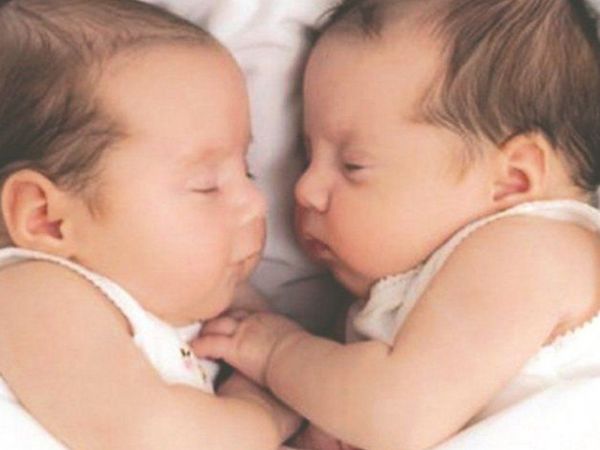 Mueren siameses tras ser separados de urgencia